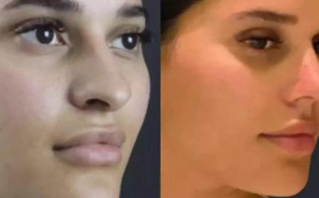 Best Doctors in Dubai for Preserving Ethnic Identity in Rhinoplasty