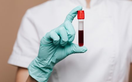 How Phlebotomy Ensures Patient Safety and Accurate Results
