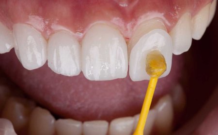 De Beste Zorg voor Uw Gebit bij Tandarts Breda Professionals