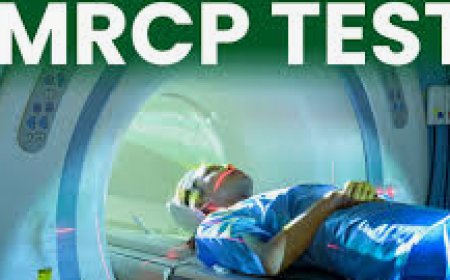 MRCP Test: Purpose, Procedure, and What You Should Know