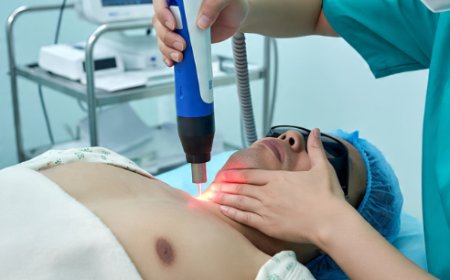 Laser Treatment for Hemangiomen: Is It Effective?