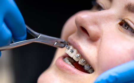 How Orthodontic Treatment Can Improve More Than Just Your Smile – Advice from Woodbridge Experts