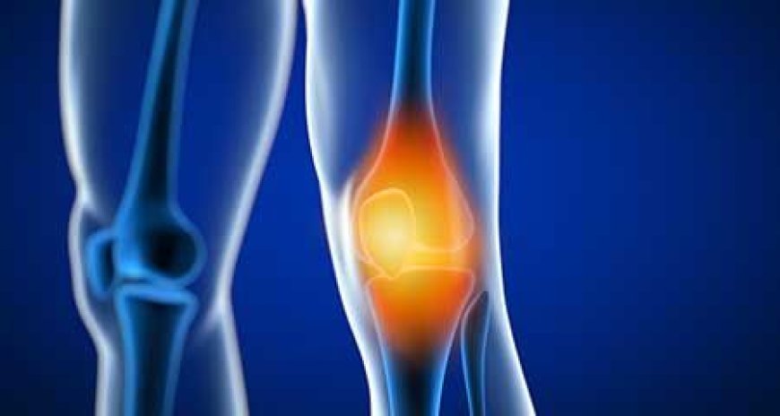 Is Knee Replacement Painful? Myths vs. Reality