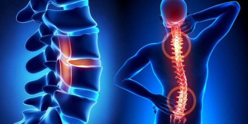 History of Lower Back Pain Relief (Lumbar Pain)