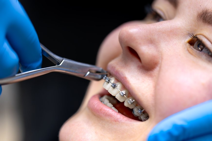 How Orthodontic Treatment Can Improve More Than Just Your Smile – Advice from Woodbridge Experts